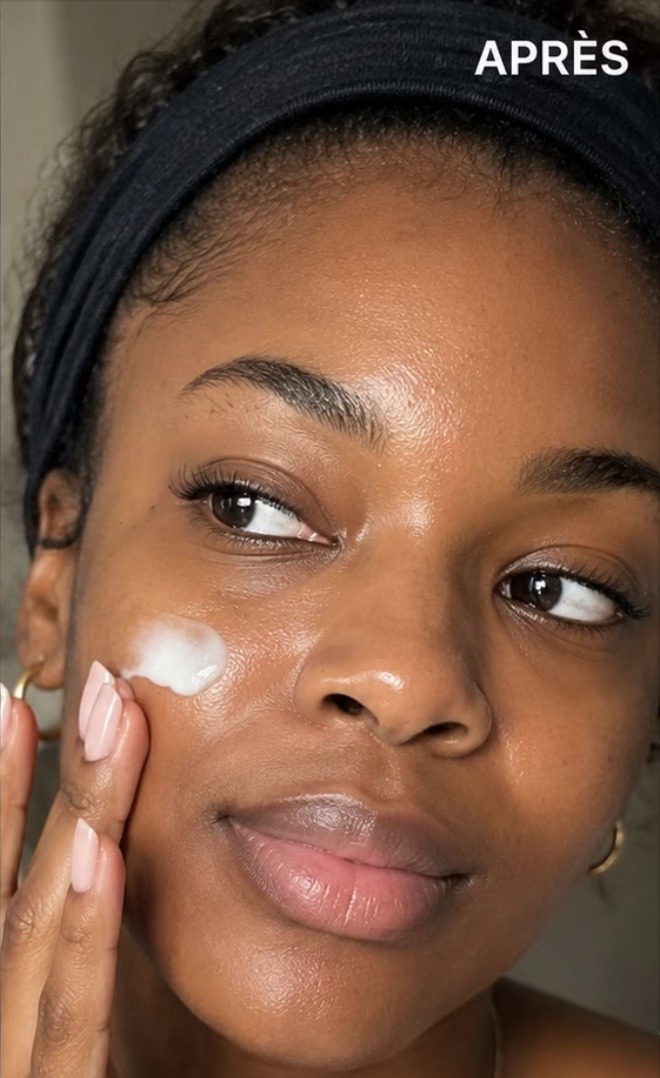 Après les soins BIOCARE — Awa N., Crème visage — 6 semaines